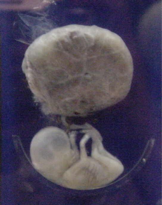 what is the length of an embryo during this time