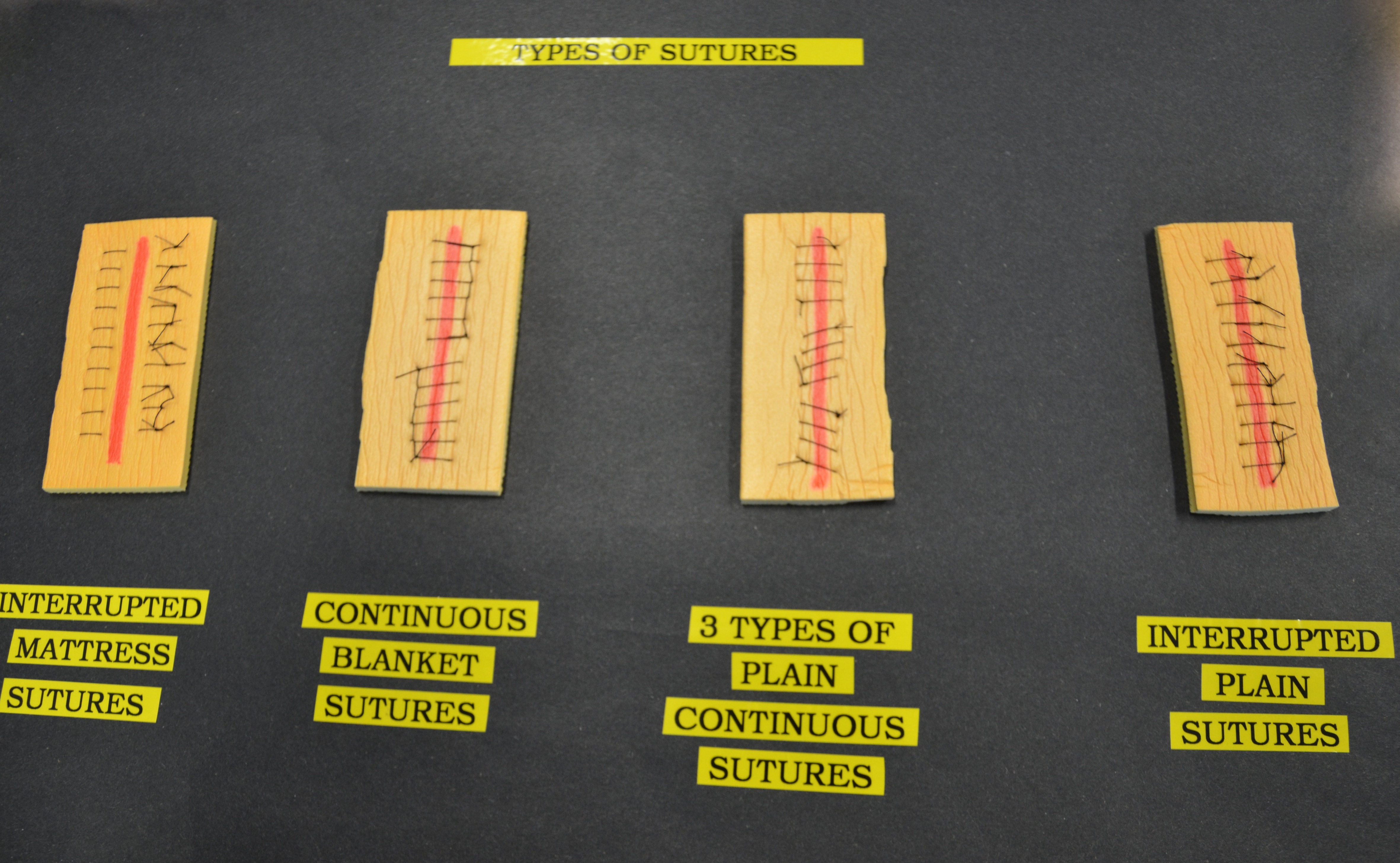 Suture Types Chart