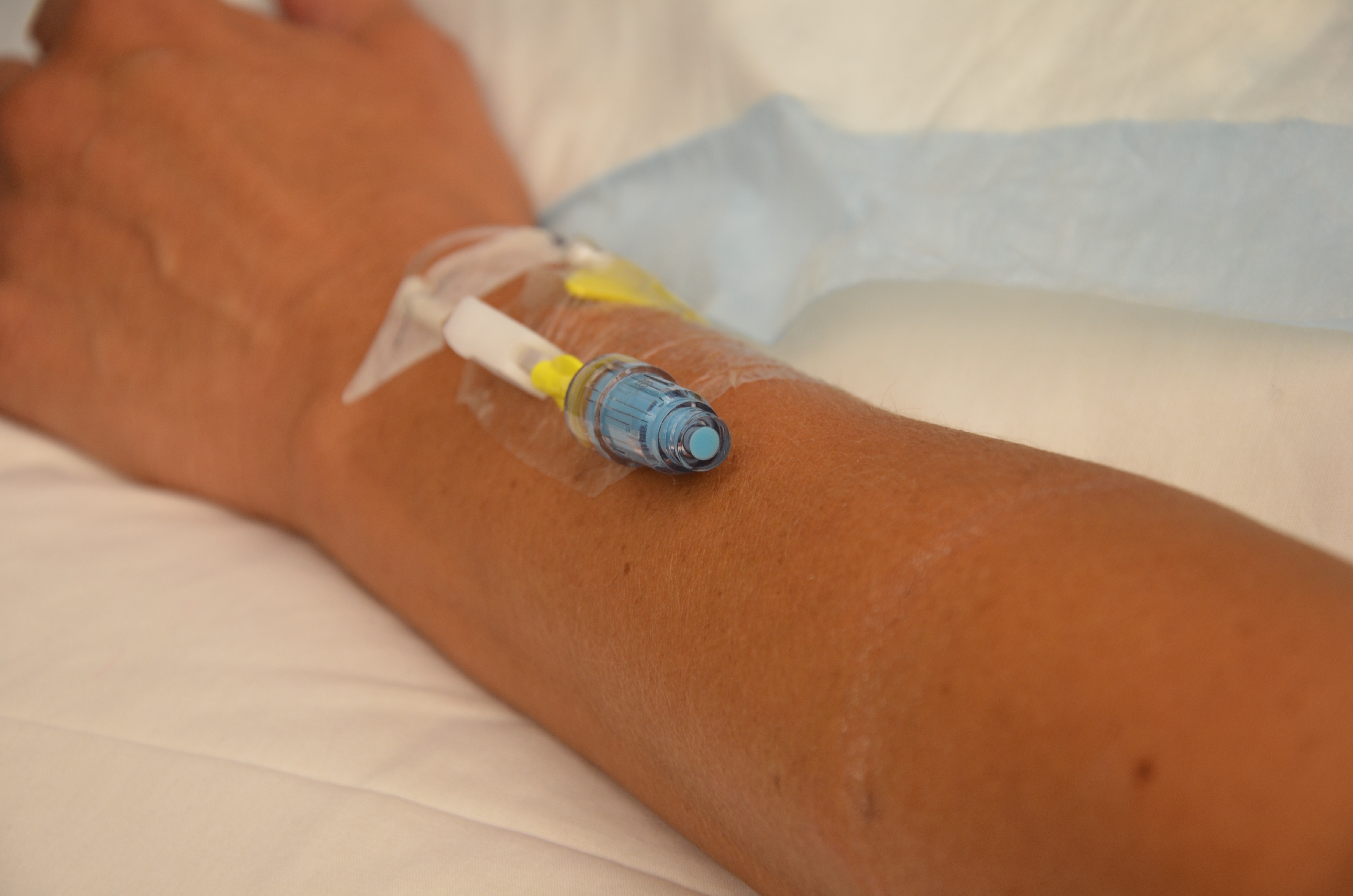 intravenous infusion procedure