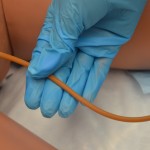 Pull catheter out slowly and smoothly