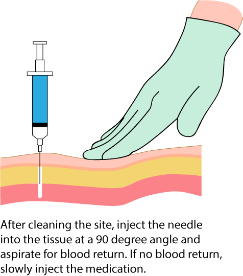 Needle Gauges For Injections Chart