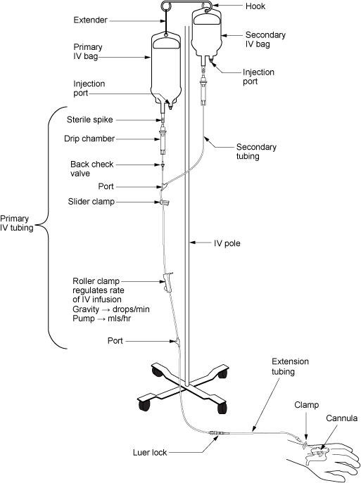 Iv Placement Chart