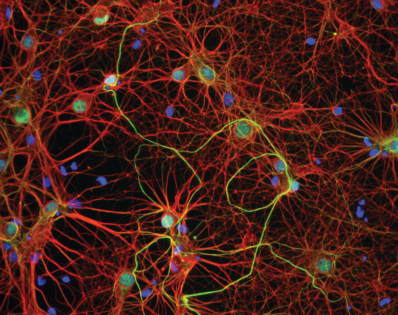 a) Biological Neurons connected by Synapses. Soma = neuron body