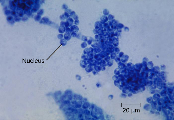 Photomicrograph of the fungus Candida albicans, with nucleus labeled.