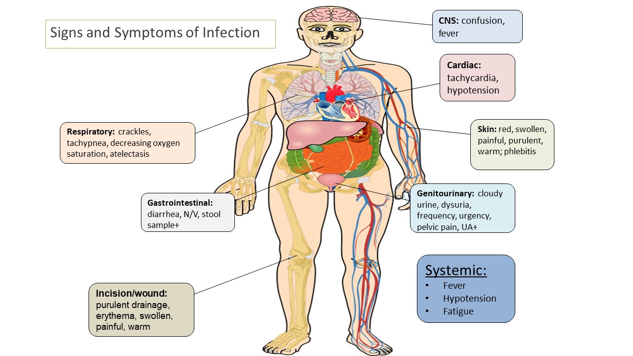 Graphic anatomical image of a human, outlining the signs and symptoms of infection that can be present in various areas of the human body.