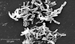 Photo of Clostridium difficile