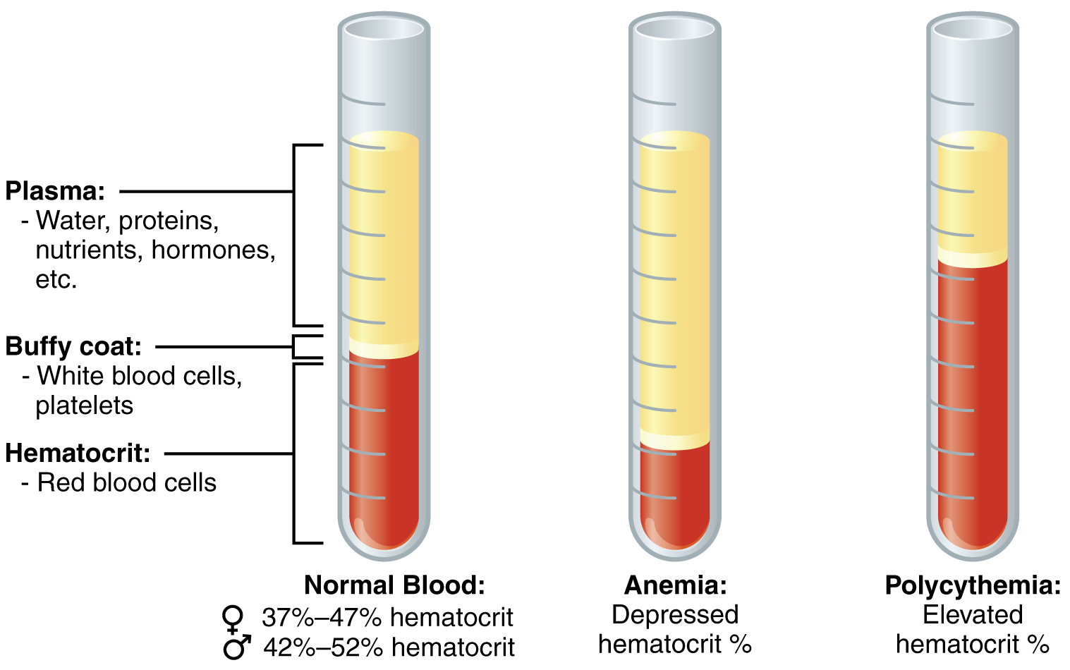 This figure shows three test tubes with a red and yellow liquid in them. The left panel shows normal blood, the center panel shows anemic blood and the right panel shows polycythemic blood. Image description available.