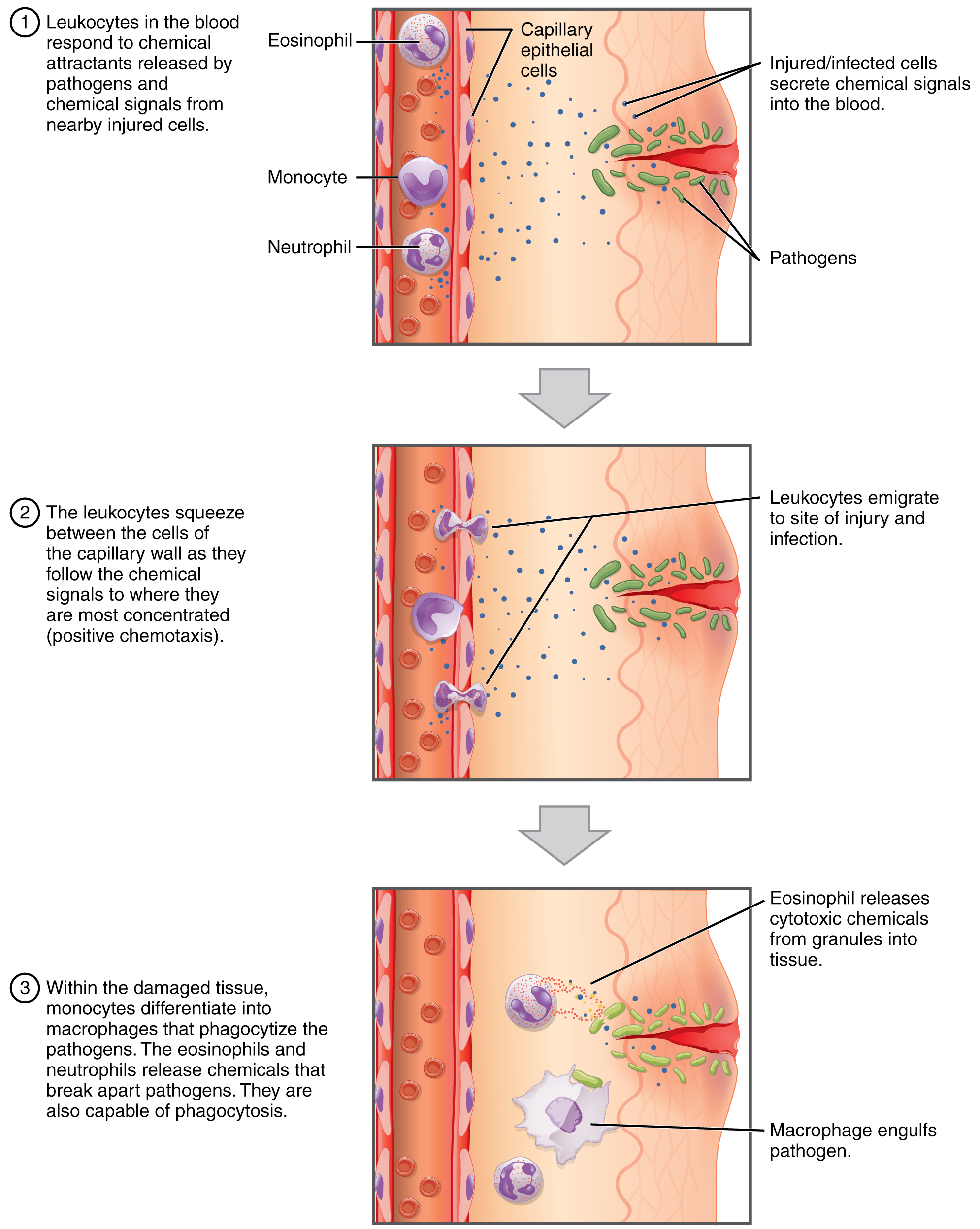 Vessel Injury Report Plaque