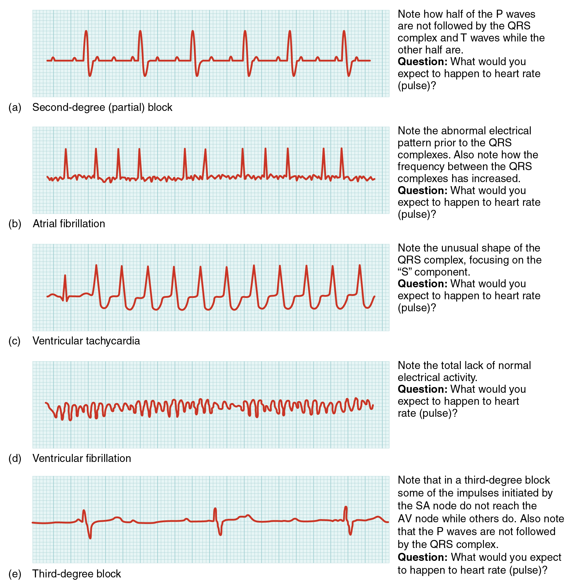 There Are Two Types Of Cardio—Here's Why They Both Matter