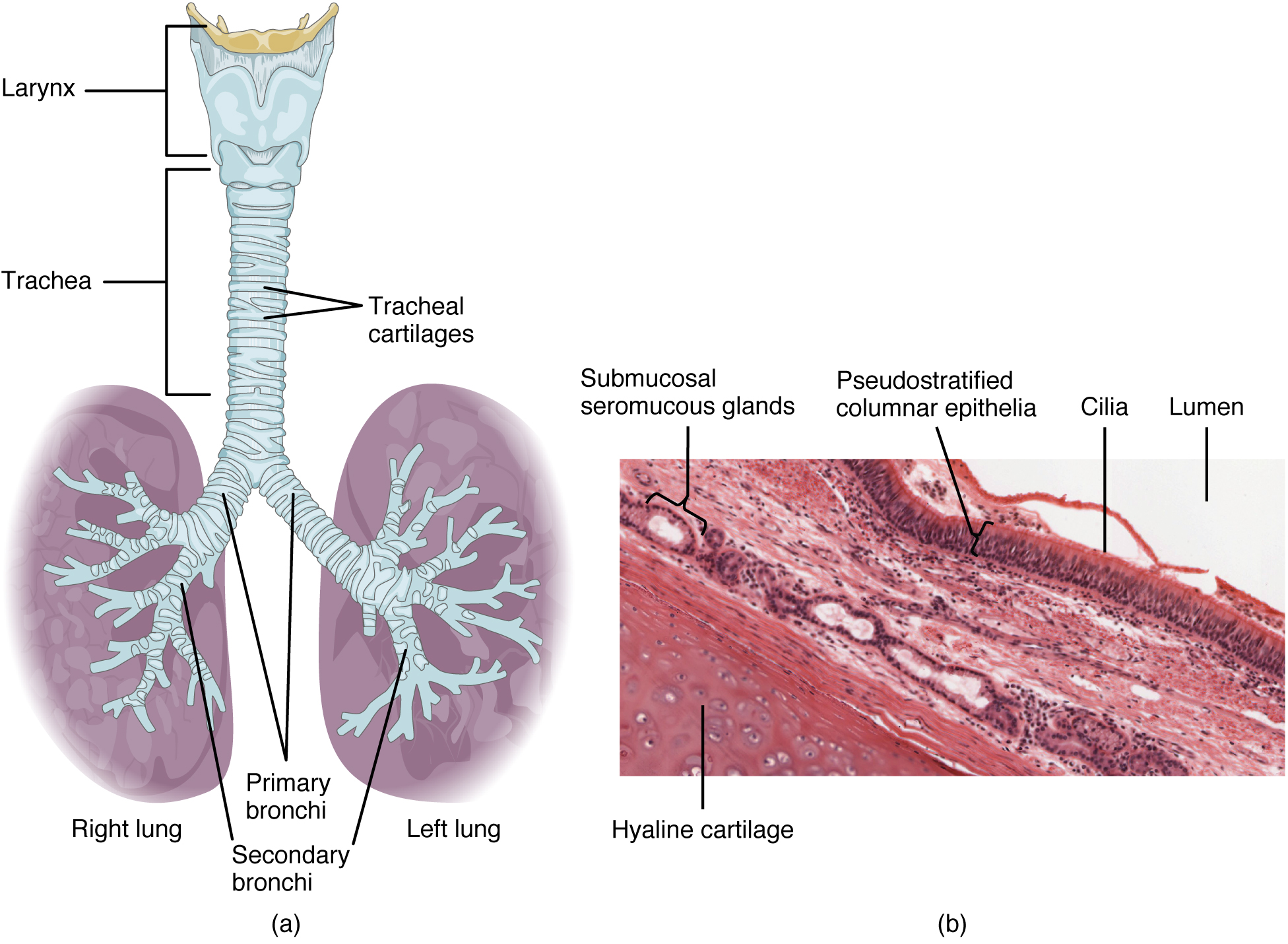 How is the trachea different from the esophagus?