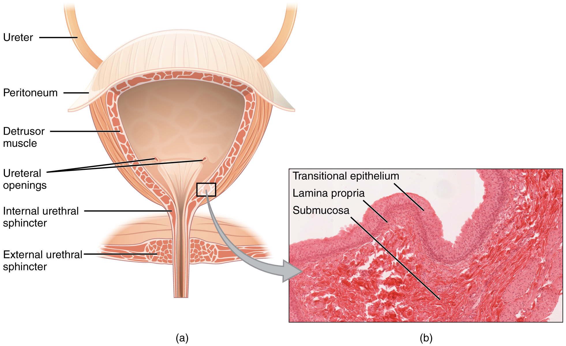 How do squamous cells get in urine?