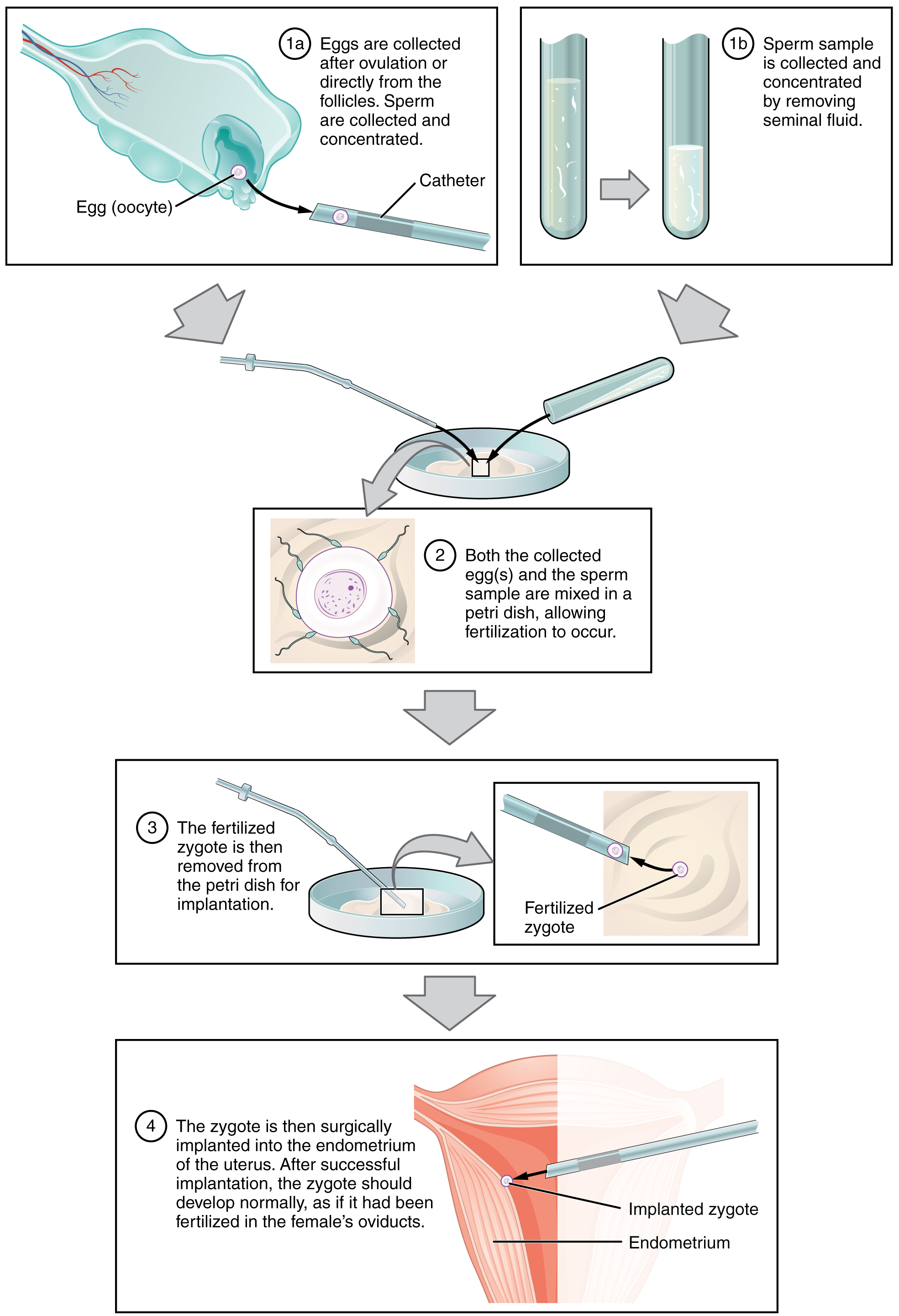 Stages of IVF. Image description available.