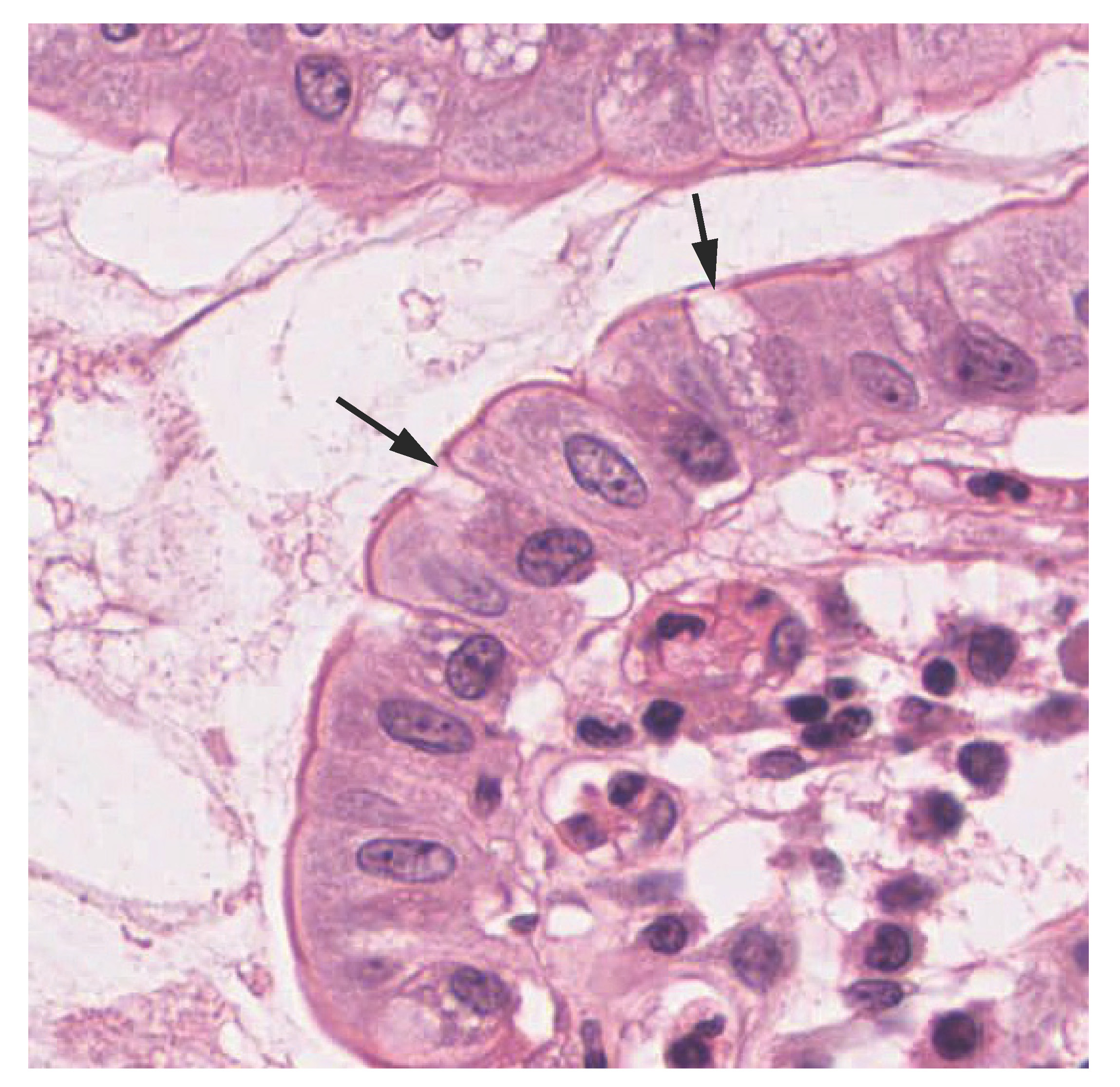 The second image is a micrograph of the innermost lining of the small intestine. This innermost lining is a simple columnar epithelium, with a single layer of rectangular cells oriented in a line. Occasionally, the line of epithelial cells is interrupted by a goblet cell. Goblet cells are thinner than the epithelial cells and appear roughly pill shaped. In this micrograph, the cells did not stain as darkly as the epithelial cells.