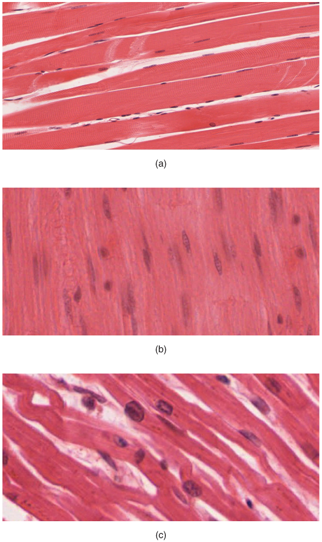 10-1-overview-of-muscle-tissues-anatomy-and-physiology