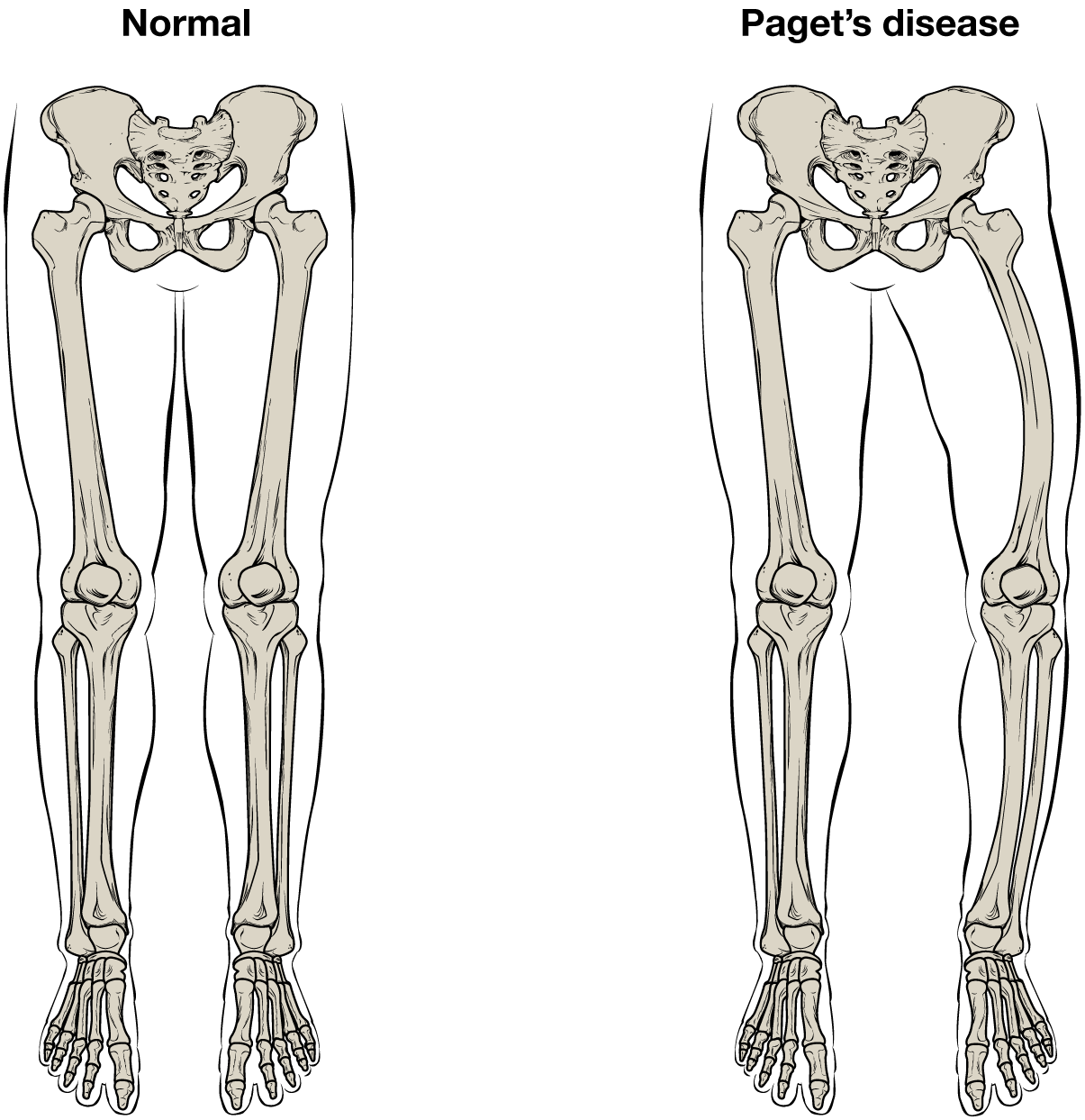 6.3 Bone Structure - Anatomy and Physiology