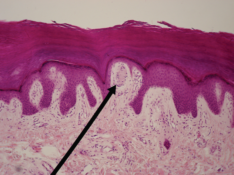 This micrograph shows a skin cross section at low magnification. The Meissner's corpuscle is a large, oval-shaped structure located in the papillary layer of the dermis, under the lowest deepest layer of the epidermis. The corpuscle contains a dark staining oval within the outer, light staining oval. Several horizontal bars are arranged vertically within the inner oval. Also, several cells with dark purple nuclei can be seen scattered throughout the corpuscle.