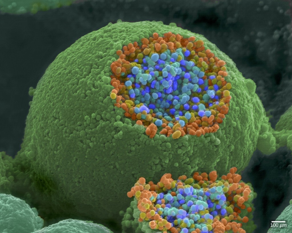 This pseudocolored image taken with a scanning electron microscope shows an axon terminal.