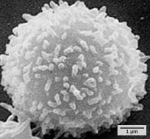 Scan of an electron micorgraph showing a T lymphocyte