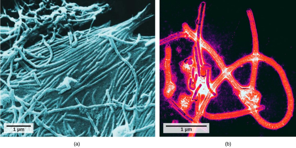 Two photos of the Ebola virus are shown. Photo A is a scanning electron micrograph. There are many three dimensional long, round ended, viruses shown. Photo B is a color enhanced transmission electron micrograph. The viruses are the same size and shape as in photo A, but here some internal structure can be seen in longitudinal cross section.