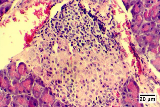 Figure 37.20.  The islets of Langerhans are clusters of endocrine cells found in the pancreas; they stain lighter than surrounding cells. (credit: modification of work by Muhammad T. Tabiin, Christopher P. White, Grant Morahan, and Bernard E. Tuch; scale-bar data from Matt Russell)