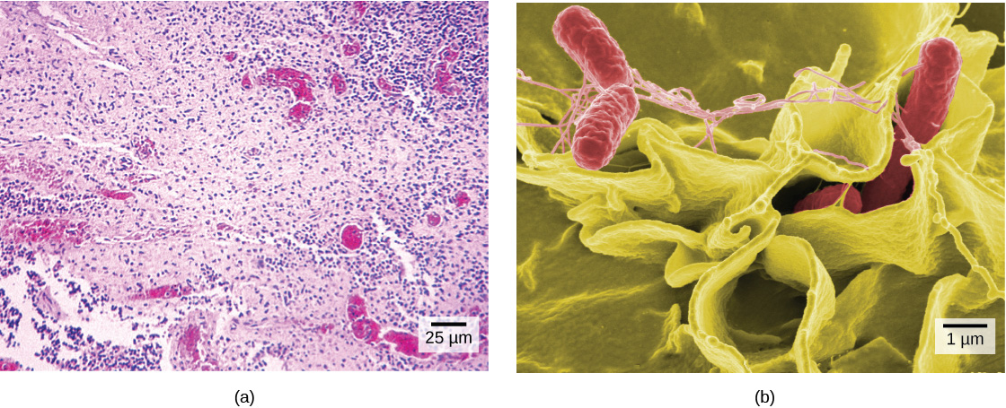 Part a: Salmonella through a light microscope appear as tiny purple dots. Part b: In this scanning electron micrograph, bacteria appear as three-dimensional ovals. The human cells are much larger with a complex, folded appearance. Some of the bacteria lie on the surface of the human cells, and some are squeezed between them.