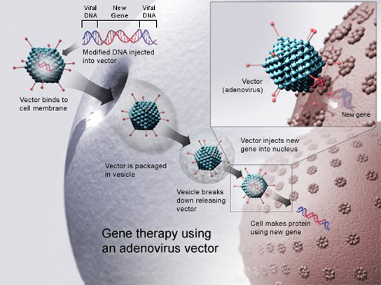 To cure disease using an adenovirus vector, a new gene intended to replace a defective one is packaged with the adenovirus genome. The genes that make the virus pathogenic are removed. The modified D N A is put inside the virus' capsid, or protein coat. The person to be cured is infected with the modified virus. Viral D N A enters the nucleus, where the modified gene can replace the defective one.