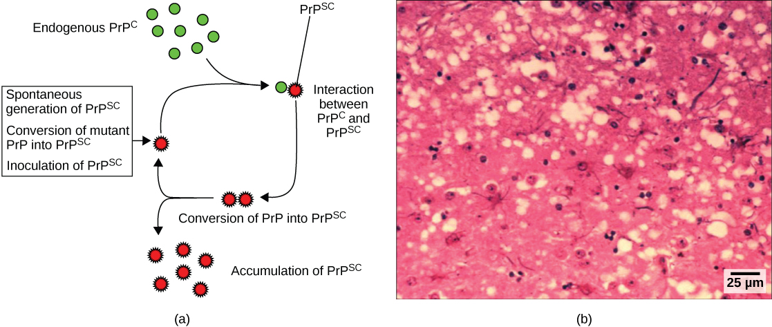 Part a illustrates how normal prion protein, called P R P, is converted into the disease causing form  P R P. P R P superscript lower case s lowercase c may spontaneously form in brain tissue, may be introduced when a mutant form of the protein misfolds, or may introduced into the brain tissue by inoculation. The misfolded protein causes normal P R P already present in the brain to misfold. A chain reaction occurs, leading to a large amount of misfolded protein.