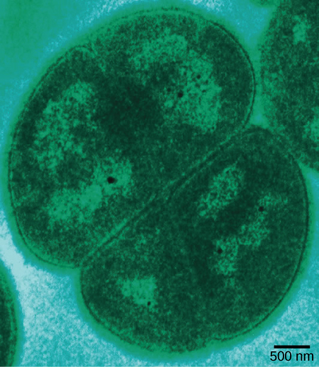 This micrograph shows an oval Deinococcus about 2.5 microns in diameter cell dividing.