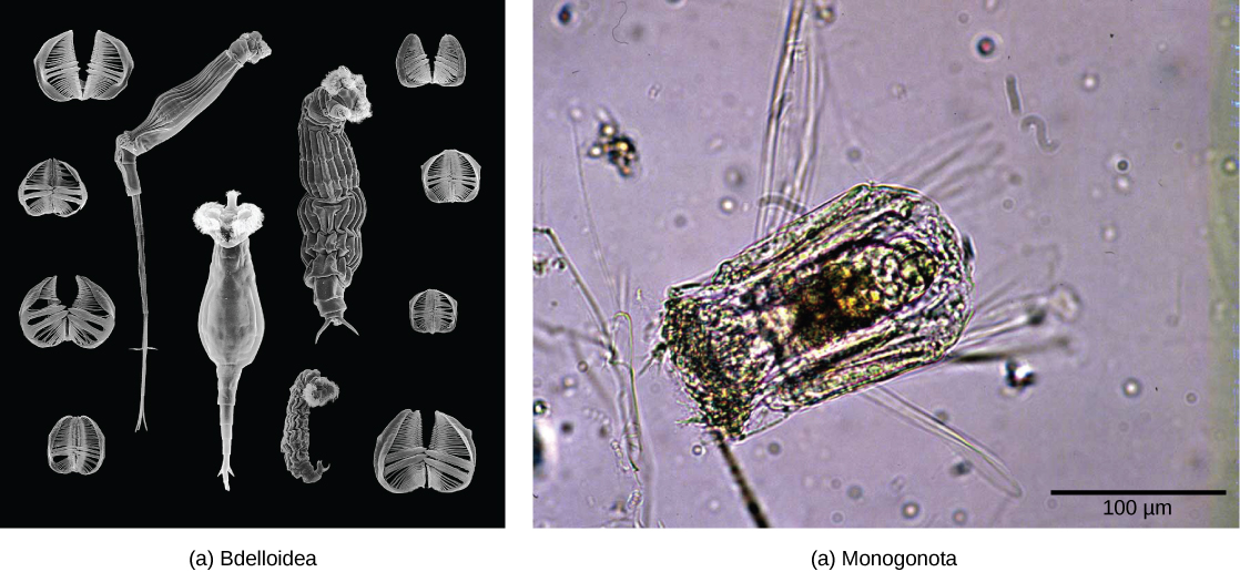 Scanning electron micrograph A shows rotifers from the class Bdelloidea, which have a long, tube-shaped body with a fringe surrounding the mouth. Light micrograph B shows that Polyarthra from the class Monogononta is shorter and wider than the bdelloid rotifers, with a smaller fringe.