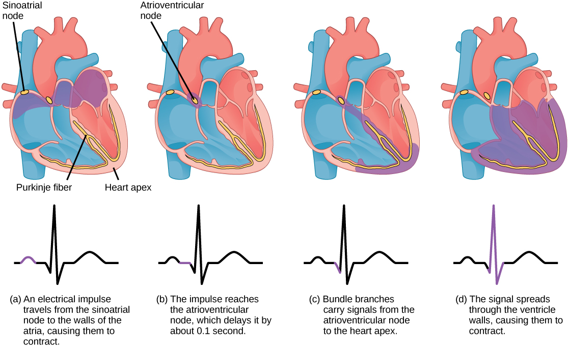 The sinoatrial node is located at the top of the right atrium, and the atrioventricular node is located between the right atrium and right ventricle. The heart beat begins with an electrical impulse at the sinoatrial node, which spreads throughout the walls of the atria, resulting in a bump in the ECG reading. The signal then coalesces at the atrioventricular node, causing the ECG reading to flat-line briefly. Next, the signal passes from the atrioventricular node to the Purkinje fibers, which travel from the atriovenricular node and down the middle of the heart, between the two ventricles, then ups the sides of the ventricles. As the signal passes down the Purkinje fibers the ECG reading falls. The signal then spreads throughout the ventricle walls, and the ventricles contract, resulting in a sharp spike in the ECG. The spike is followed by a flat-line, longer than the first then a bump.
