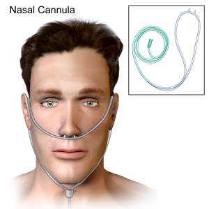 Figure 9.3.5 Client with a nasal cannula 