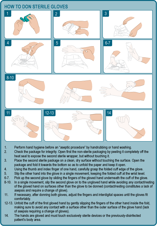 Don Sterile Gloves Clinical Procedures for Safer Patient Care