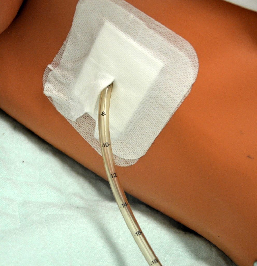 10 6 Chest Tube Drainage Systems Clinical Procedures For Safer 