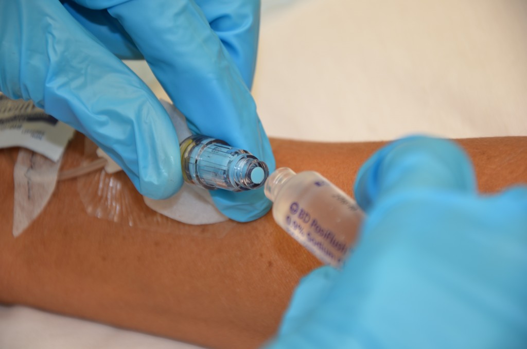 8.6 Converting an IV Infusion to a Saline Lock and Removal of a