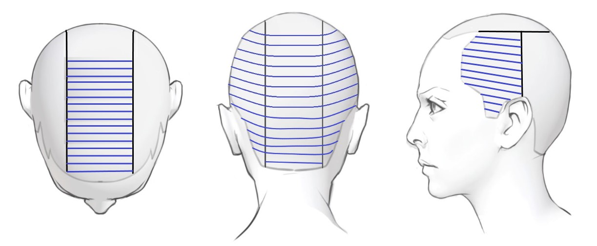 Horizontal foils on three sections of the head: top, back, and sides.