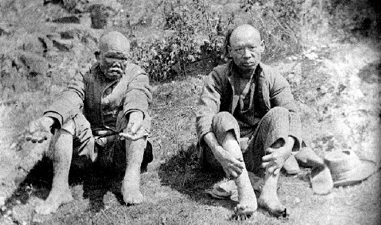 Black and white photo of two Chinese lepers on D'Arcy Island, BC. in the 1890s.