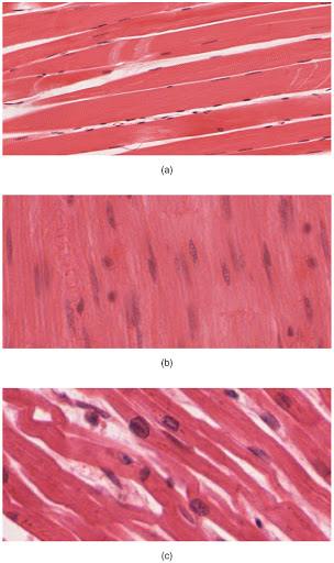 Micrographs of three types of muscles.