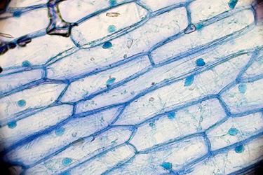 Cell membranes of onion cells, similar in appearance to a section of a brick wall.