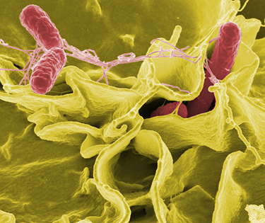 A magnified image of the bacterium Salmonella attacking a human cell. The bacterium is rod shaped and about zero point seven to one point five micrometers in diameter and two to five micrometers in length.