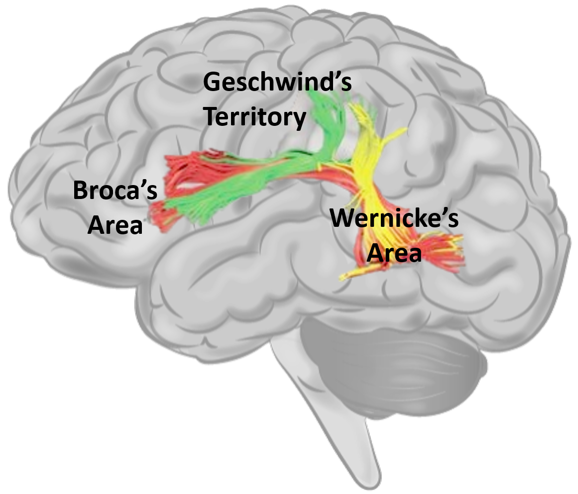 Language areas of the brain include Broca's area. Geschwind's territory, and Wernicke's area
