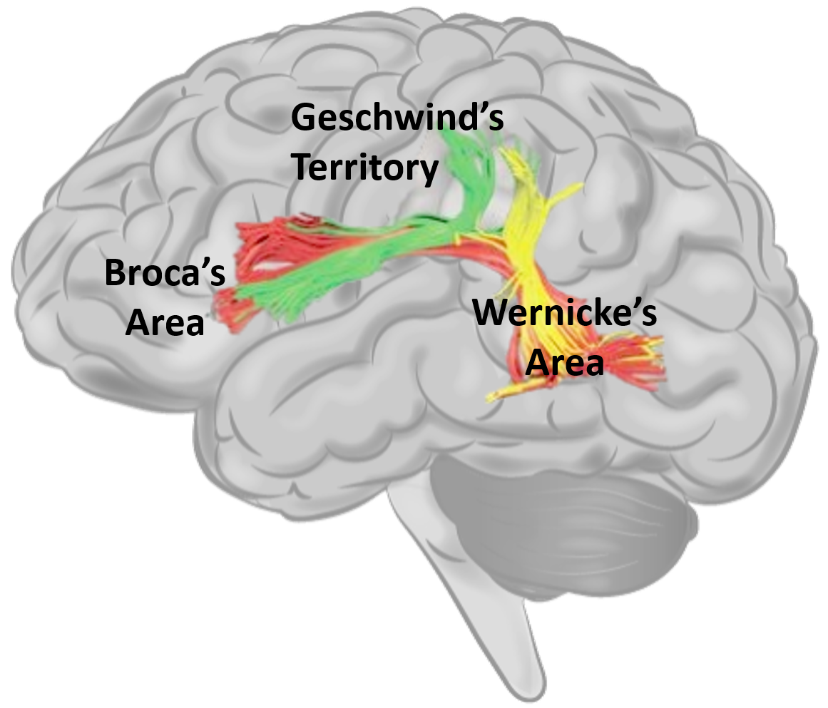 Wernicke's & Broca's aphasia Brain & Language LING 411/412/489