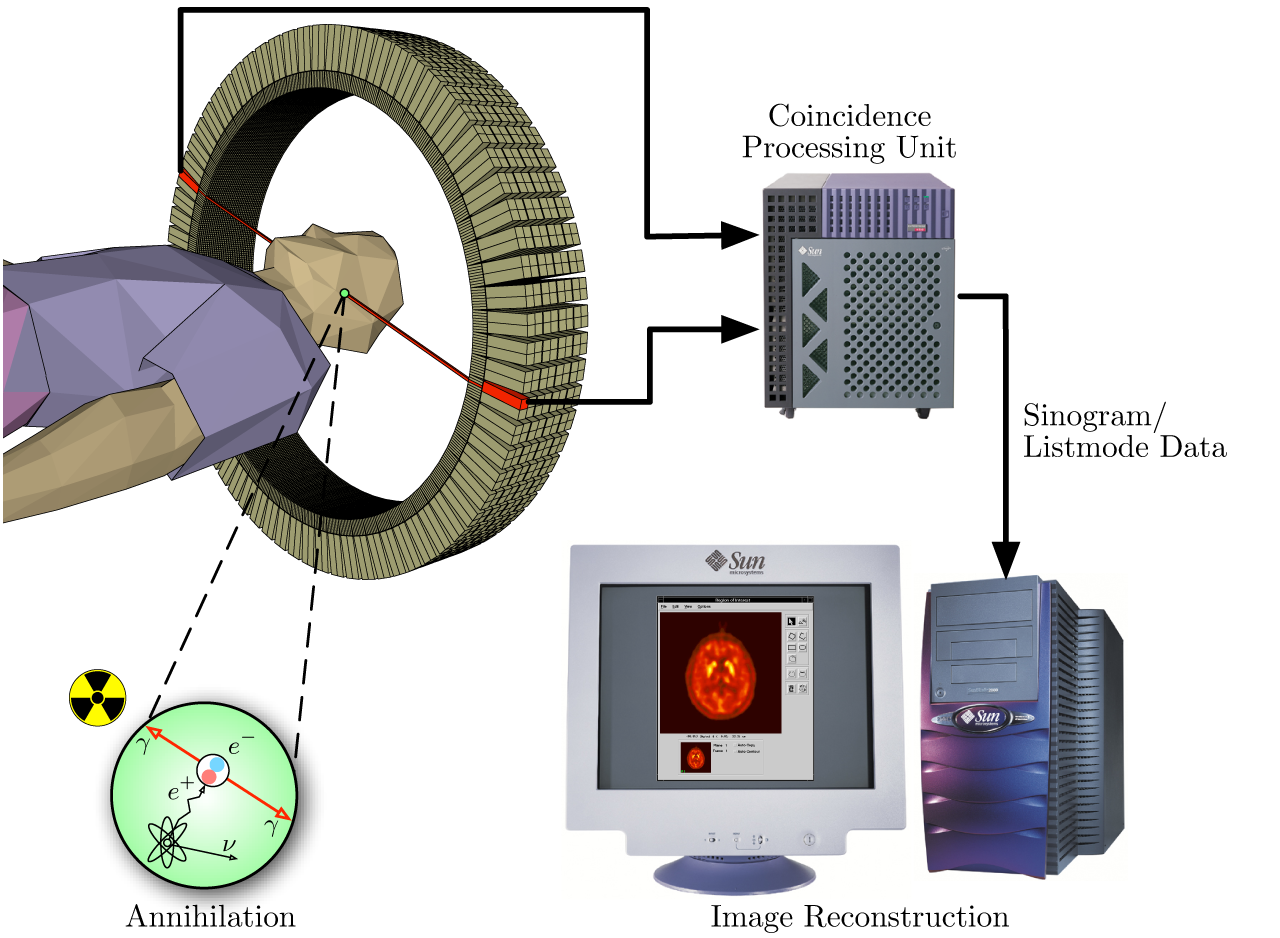 Function of a PET machine. Image description linked to in caption.