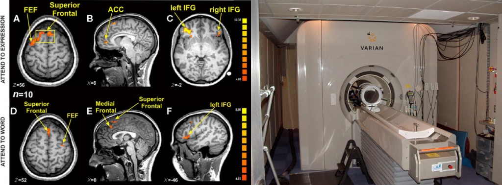 mri