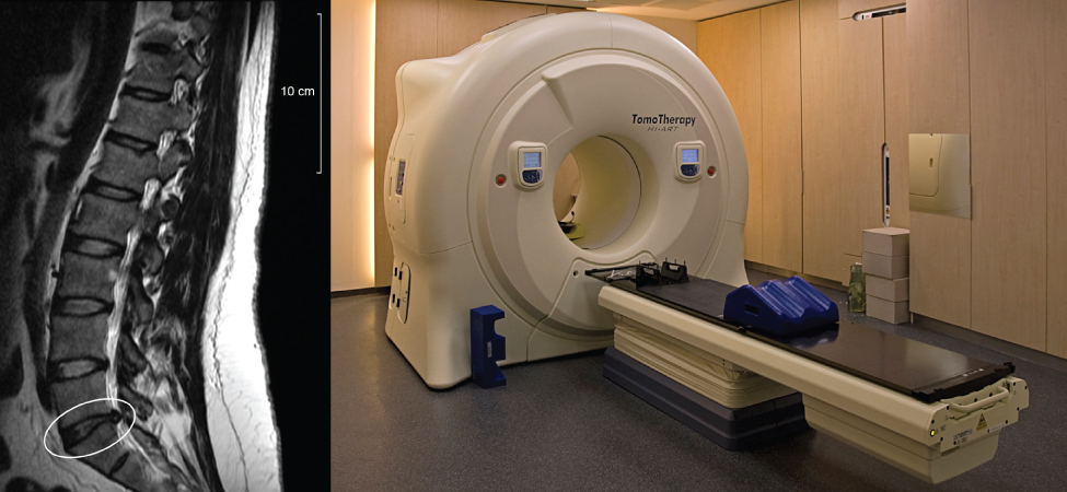 Left picture shows an image of the human spinal column taken using magnetic resonance imaging. Left picture is a photograph of the magnetic resonance imaging instrument.