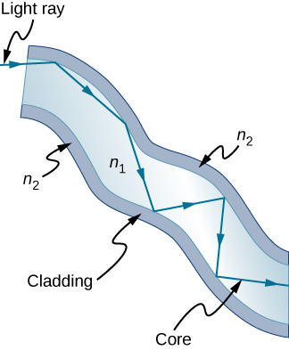 La figure montre une fibre avec un milieu d'indice de réfraction n 1 entouré d'un milieu n 2. Le milieu n sub 2 est constitué du matériau de gaine et n sub 1 est le cœur. Le rayon lumineux se réfléchit à l'interface entre le cœur et la gaine, restant à l'intérieur du cœur lorsqu'il se déplace le long de la fibre.