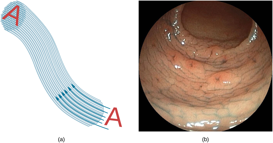 La figure (a) montre comment une image A est transmise par un faisceau de fibres parallèles. La figure (b) montre une image d'endoscope.