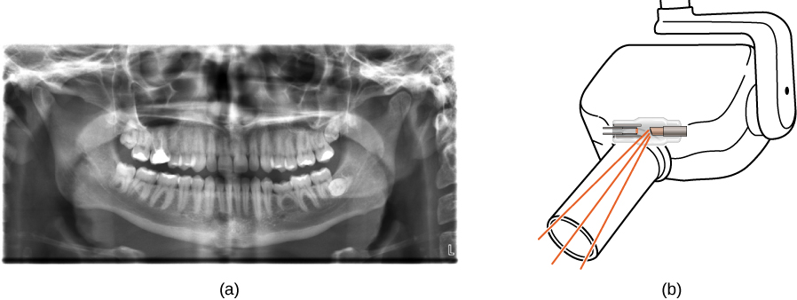 Figure (a) shows an X-ray image of front view of the jaw, especially the teeth. Figure (b) shows a drawing of an dental x ray machine.